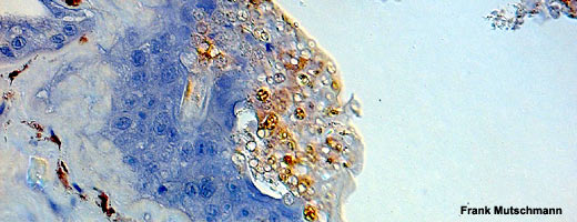 Mikroskop-Aufnahme eines Chytridpilzes auf der Haut eines australischen Korallenfinger-Laubfroschs (Litoria caerulea).